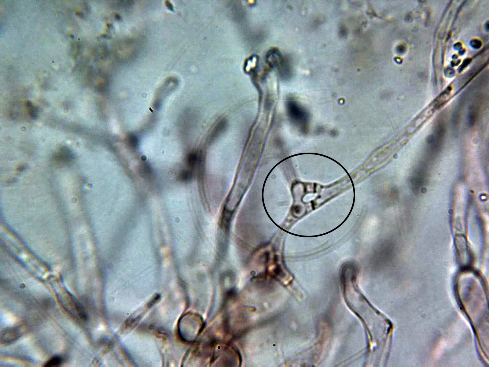 10 - Hifa curiosa suprapellis